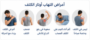 أعراض التهاب أوتار الكتف